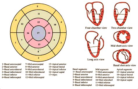 17 segments of the heart.